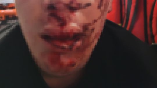 Pilne! Brutalne pobicie piłkarza w Józefowie! Rodzina poszukuje świadków!