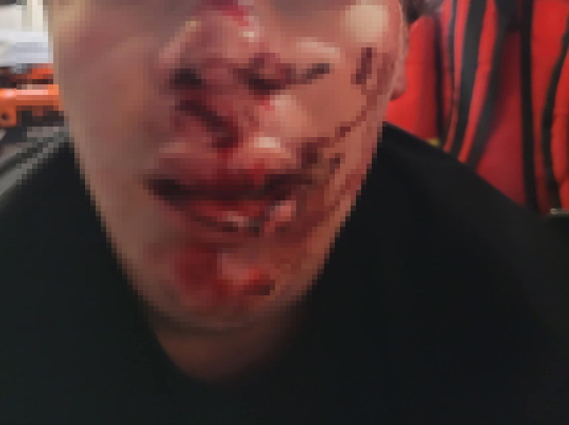 Pilne! Brutalne pobicie piłkarza w Józefowie! Rodzina poszukuje świadków!